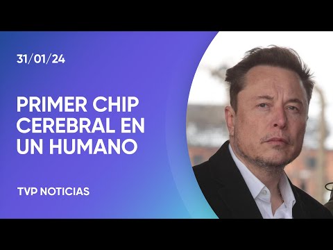 Elon Musk y el primer chip cerebral en un humano Elon Musk y el primer chip cerebral en un humano