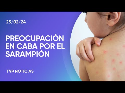 PreocupaciÃ³n en CABA por un caso de sarampiÃ³n