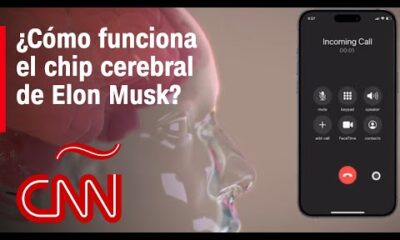 Así funciona el chip cerebral de Elon Musk