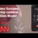 Así funciona el chip cerebral de Elon Musk