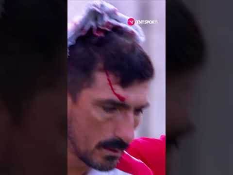 DURÍSIMO GOLPE 🤕 Quiso atajar una pelota y terminó cortado con el techo del banco de suplentes