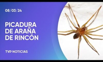 Recomendaciones por la picadura de una araÃ±a de rincÃ³n