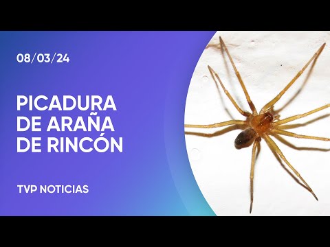 Recomendaciones por la picadura de una araña de rincón Recomendaciones por la picadura de una araña de rincón