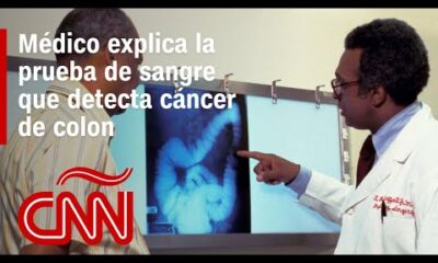 Médico explica cómo funciona la prueba de sangre que detecta el cáncer de colon