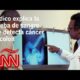 Médico explica cómo funciona la prueba de sangre que detecta el cáncer de colon