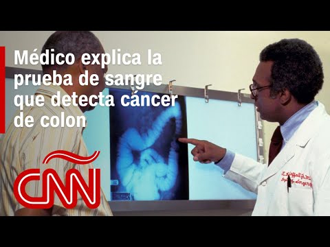 Médico explica cómo funciona la prueba de sangre que detecta el cáncer de colon Médico explica cómo funciona la prueba de sangre que detecta el cáncer de colon