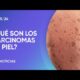 ¿Qué son los carcinomas de piel?