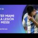 Messi tiene una lesión ligamentaria, pero no será operado