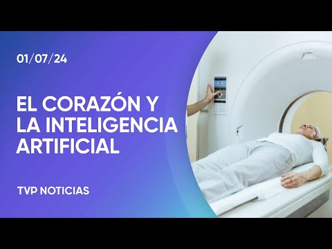 Tomografías del corazón por IA