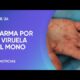 Alerta mundial por la viruela símica