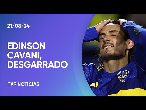 Cavani se lesionó y no jugará la revancha contra Cruzeiro