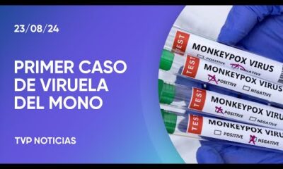 Viruela del Mono en la Argentina: confirmaron el primer caso sin antecedentes de viaje