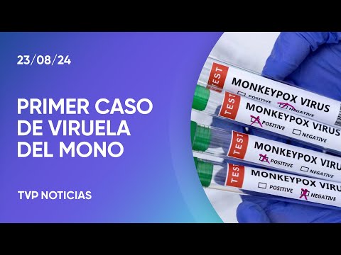 Viruela del Mono en la Argentina: confirmaron el primer caso sin antecedentes de viaje Viruela del Mono en la Argentina: confirmaron el primer caso sin antecedentes de viaje
