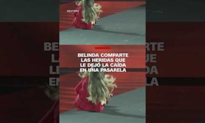 Belinda comparte las heridas que le dejó la caída en una pasarela