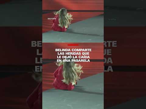 Belinda comparte las heridas que le dejó la caída en una pasarela Belinda comparte las heridas que le dejó la caída en una pasarela