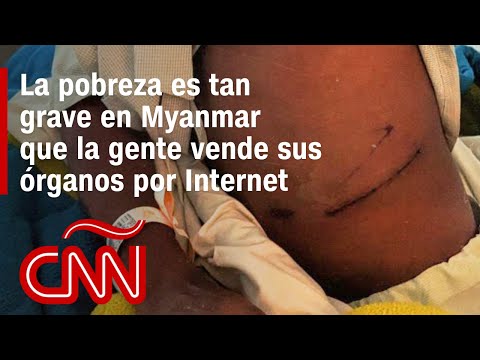 La pobreza es tan grave en Myanmar que la gente se ofrece a vender sus riñones por Internet La pobreza es tan grave en Myanmar que la gente se ofrece a vender sus riñones por Internet