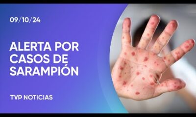 Alerta por casos de sarampión