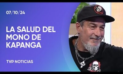 El Mono de Kapanga habló de su salud después de reprogramar sus shows: