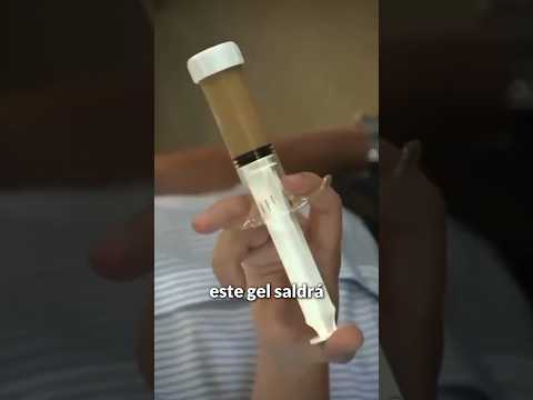 ESTE GEL DETIENE EL SANGRADO!!! ESTE GEL DETIENE EL SANGRADO!!!