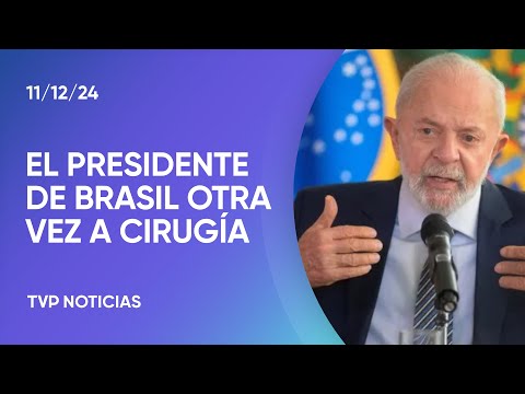 Brasil: Lula volverá a ser operado