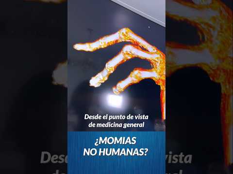 Médico ve tomografías de estos seres por primera vez…