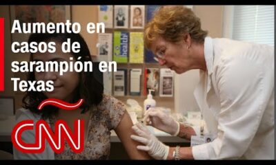 Brote de sarampión en Texas: experto ofrece consejos para evitar el contagio