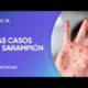 Confirmaron el cuarto caso de sarampión en CABA Confirmaron el cuarto caso de sarampión en CABA