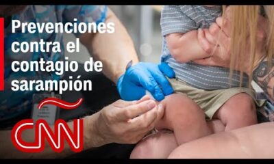 El sarampión es la enfermedad más contagiosa que existe”, dice infectólogo