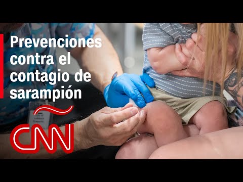El sarampión es la enfermedad más contagiosa que existe”, dice infectólogo