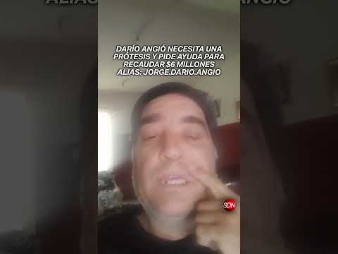Campaña solidaria: Darío Angió necesita una prótesis y pide ayuda para recaudar $6 millones